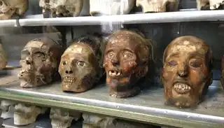 The Anatomy Museum (or horrors) of Montpellier